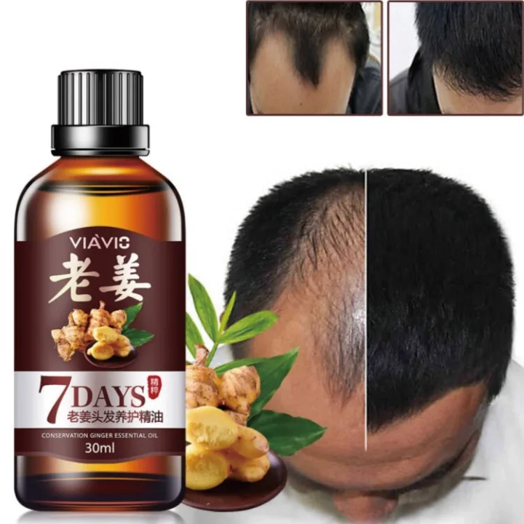 7 Days Good Work Natural Organic Oil Ginger Hair Growth Oil for Hair Care, Clear liquid
7 Days Good Work Natural Organic Oil Ginger Hair Growth Oil for Hair Care, Clear liquid