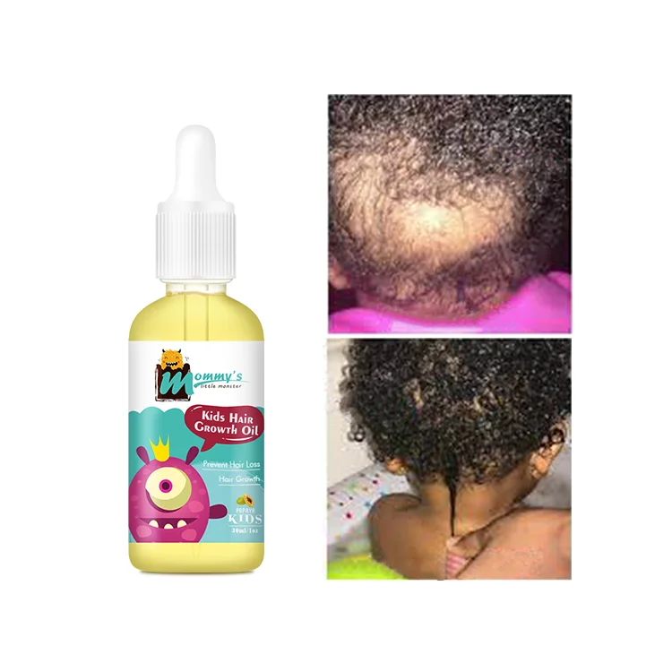 Vegan Natural Kids Hair Growth Sets Extreme Hair Growth Oil for Baby
Vegan Natural Kids Hair Growth Sets Extreme Hair Growth Oil for Baby