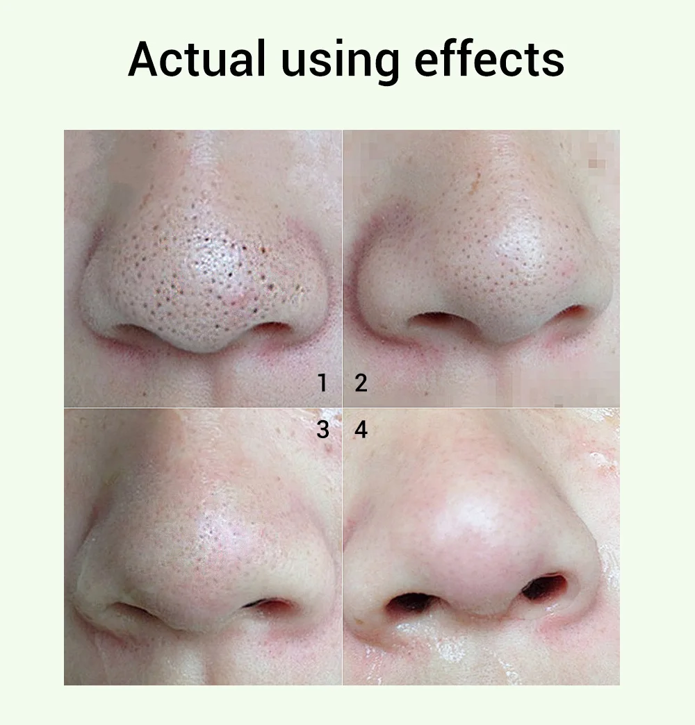 shrink pores oil (8).jpg