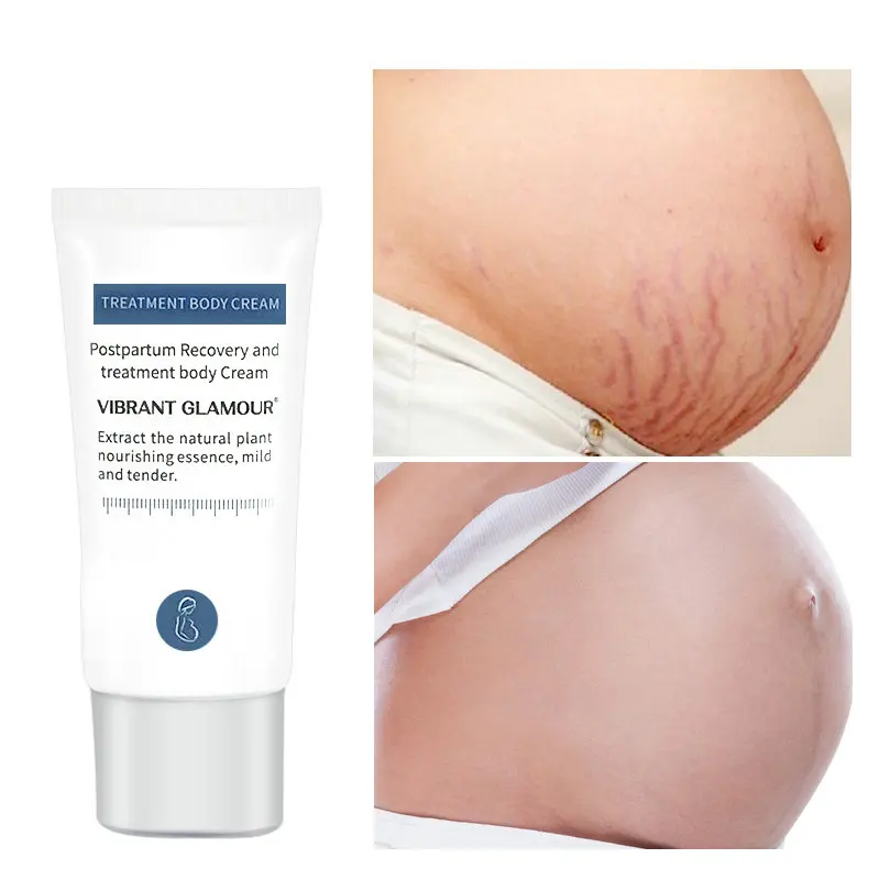 Vibrant Glamour Wholesale Pregnant Woman Postpartum Repair Cream Reduce Obesity Lines Cream
Vibrant Glamour Wholesale Pregnant Woman Postpartum Repair Cream Reduce Obesity Lines Cream