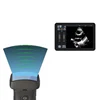 /product-detail/w8a-handheld-hospital-mini-ultrasound-machine-wireless-probe-color-doppler-ultrasound-probe-scanner-62390721984.html