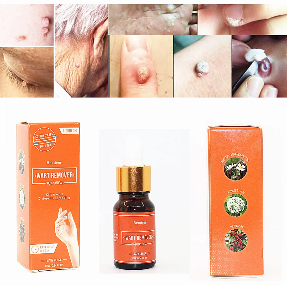 wart remover serum (8).jpg