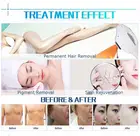 Laser Hair Removal Machine Ipl Facial Skin Treatment Intense Pulsed Light
