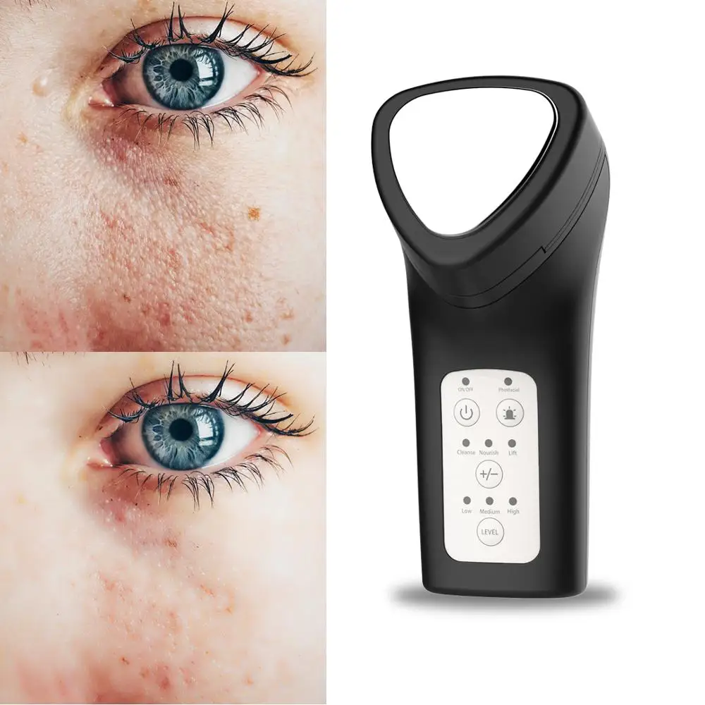 J-style 4 in 1 Photon Therapy LED Facial Skin Lifting Microcurrent Vibration Face Massager Tighten Rechargeable Beauty Device
J-style 4 in 1 Photon Therapy LED Facial Skin Lifting Microcurrent Vibration Face Massager Tighten Rechargeable Beauty Device