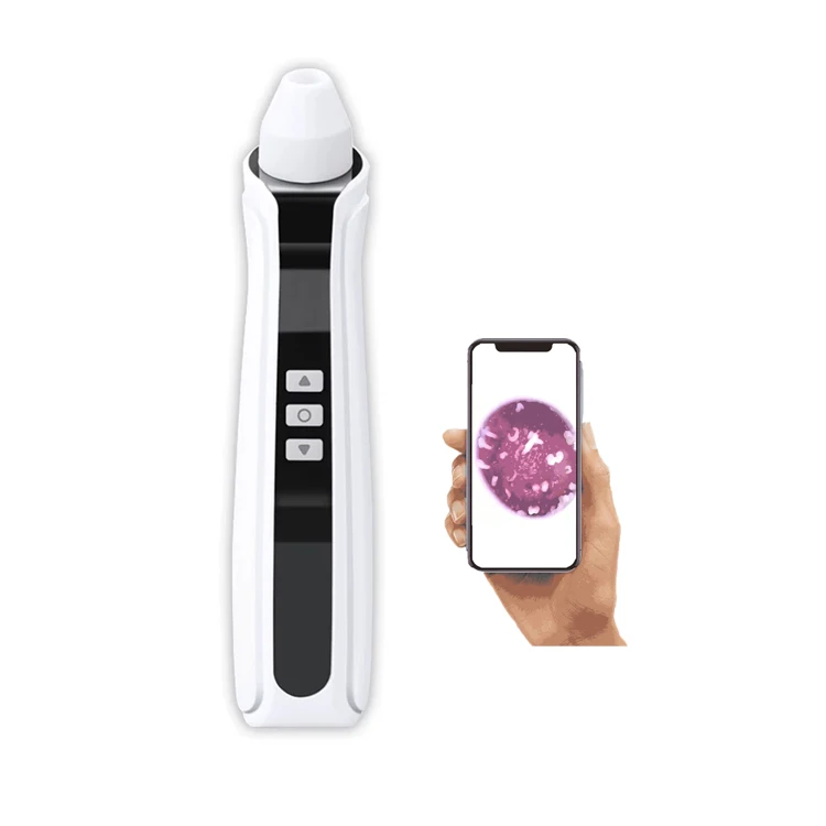 Facial Portable Electric Pore Cleaner Blackhead Remover Vacuum with Camera, Black
Facial Portable Electric Pore Cleaner Blackhead Remover Vacuum with Camera, Black