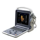 Medical Instrument Diagnosis System Portable Ultrasound Scanner with 3/4D With 4D volume probe