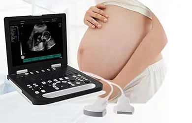 Portable ultrasound machine