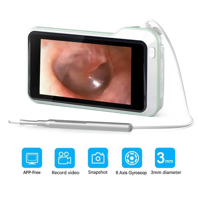 digital otoscope camera