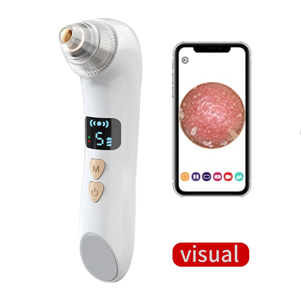 Pore Cleaner Black Head Suction Extractor Tool Kit Acne Removal Vacuum Blackhead Remover
Pore Cleaner Black Head Suction Extractor Tool Kit Acne Removal Vacuum Blackhead Remover