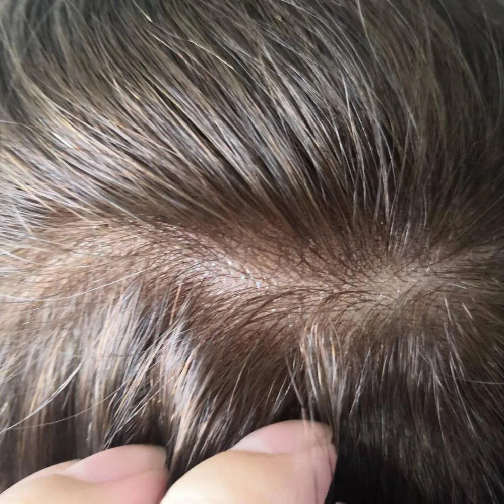 Wholesale Ready Stock European Human Hair 0.08mm PU Injection Full Thin Skin Men Hair Toupee
Wholesale Ready Stock European Human Hair 0.08mm PU Injection Full Thin Skin Men Hair Toupee
