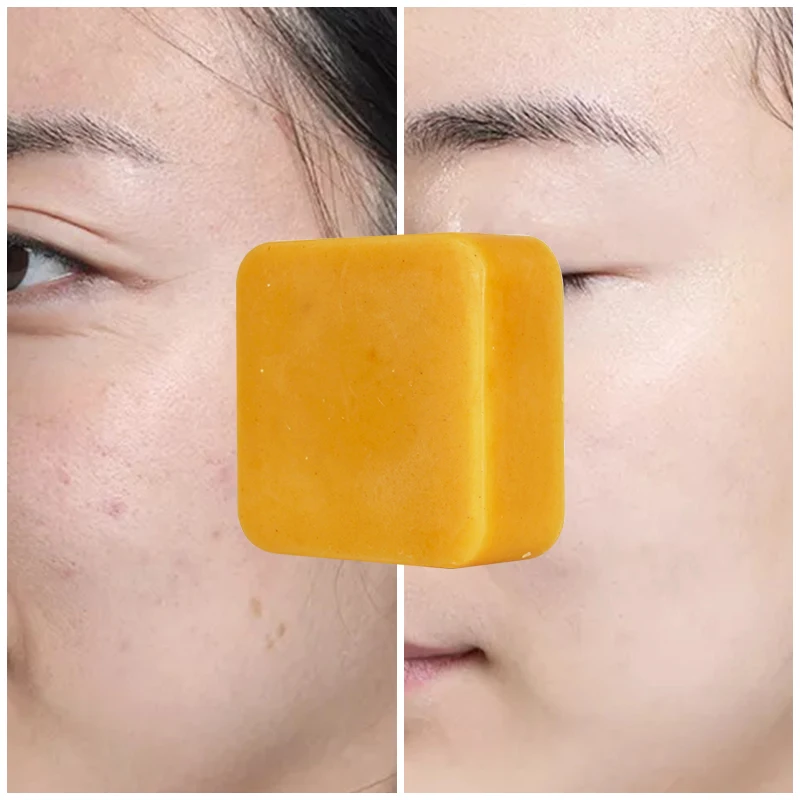 OEM Face Skin Whitening Anti Acne Natural Organic Handmade Turmeric Bath turmeric savon
OEM Face Skin Whitening Anti Acne Natural Organic Handmade Turmeric Bath turmeric savon