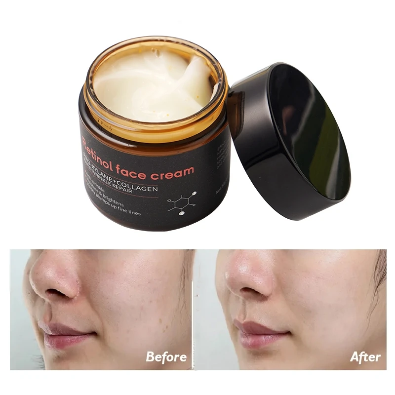 Waterproof Collagen Moisturising Chinese Night Cream For Whitening Face And Dark Spot
Waterproof Collagen Moisturising Chinese Night Cream For Whitening Face And Dark Spot