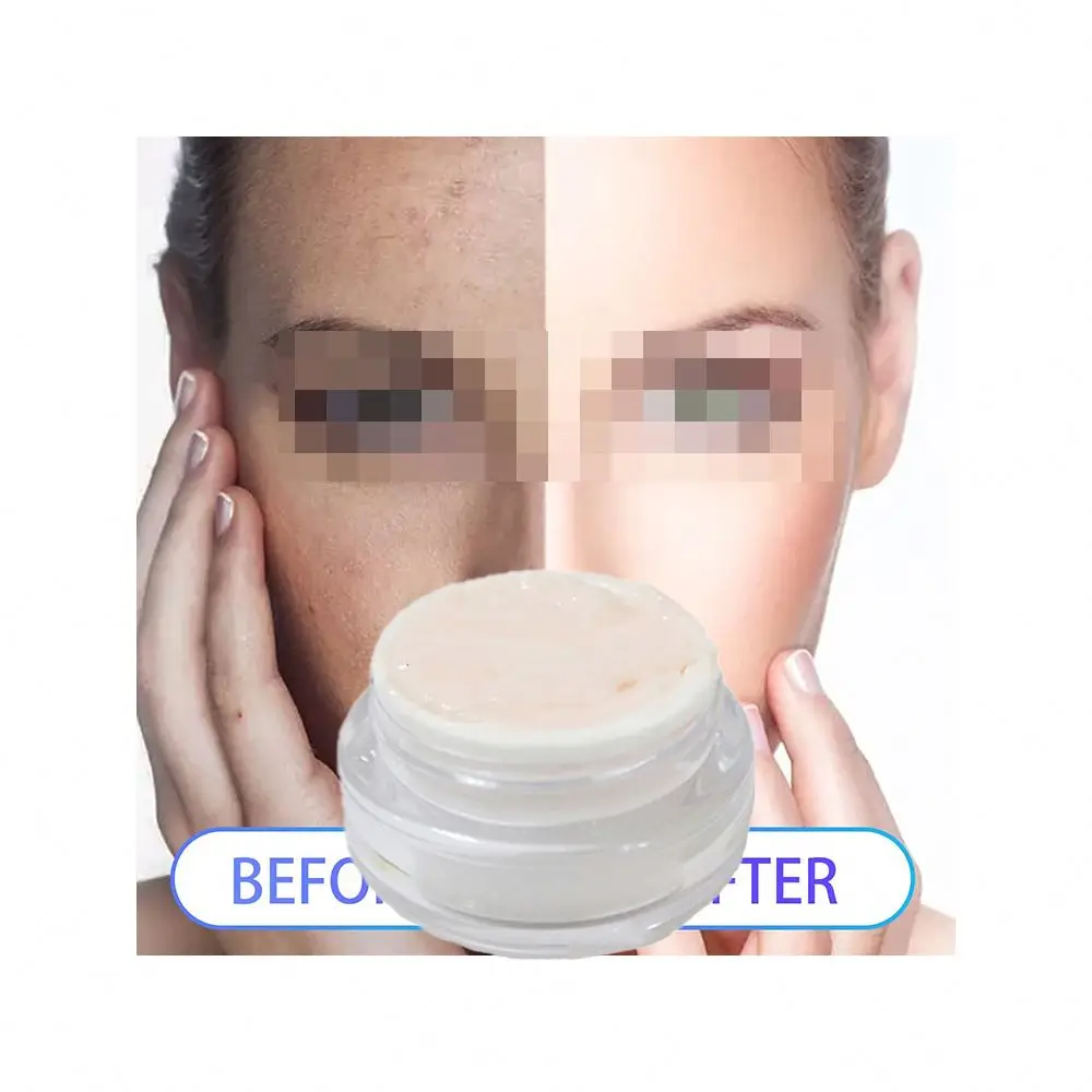 Bee Venom Peptide Intensive Repair Moisturizing Dark Spot Removing Cream Sold by Weight
Bee Venom Peptide Intensive Repair Moisturizing Dark Spot Removing Cream Sold by Weight