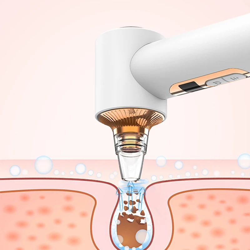 Meizons 2020 NEW Patent Customized logo multi-functional beauty equipment blackhead remover vacuum, Customized color
Meizons 2020 NEW Patent Customized logo multi-functional beauty equipment blackhead remover vacuum, Customized color