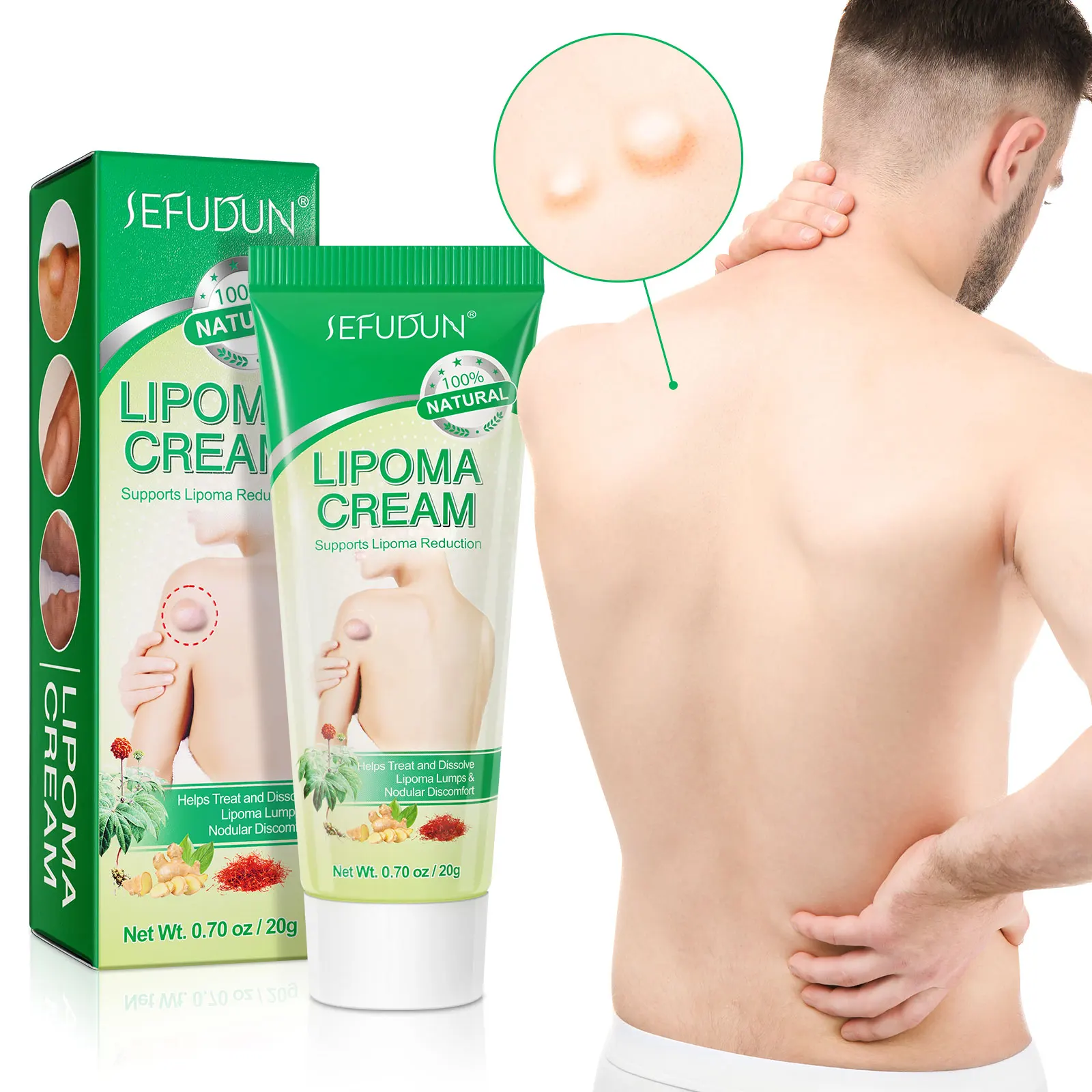 

OEM Private Label Natural Herbal Lipoma Removal Cream Anti Swelling Lymphatic Detox Ointment Fat Lump Removal Lipoma Cream