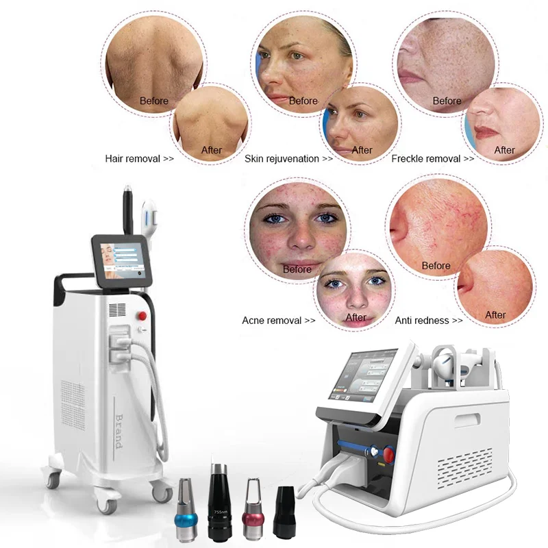 Factory supply DPL IPL+Pico Sure Powerful Hair Removal Skin Rejuvenation and Tattoo Removals Removal
Factory supply DPL IPL+Pico Sure Powerful Hair Removal Skin Rejuvenation and Tattoo Removals Removal
