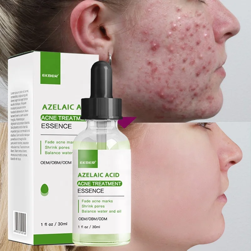 Korean Cosmetics Black Head Remover Beauty Face Skin Care Anti Acne Removal Azelaic Acid Serum Products
Korean Cosmetics Black Head Remover Beauty Face Skin Care Anti Acne Removal Azelaic Acid Serum Products