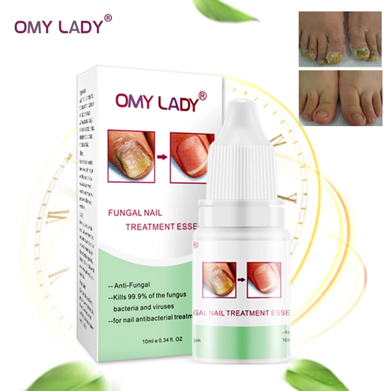 OMY LADY Herbal Nail Fungus Treatment anti fungal nail solution toe fungal nail treatment kit, Clear
OMY LADY Herbal Nail Fungus Treatment anti fungal nail solution toe fungal nail treatment kit, Clear