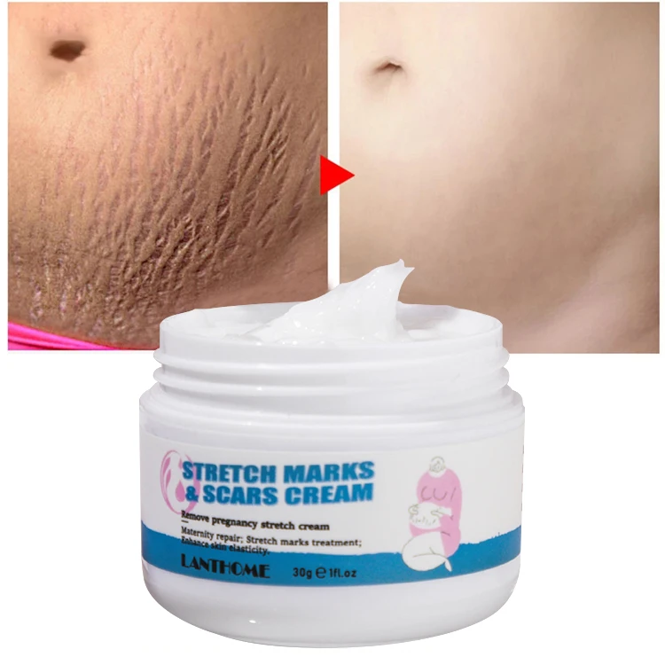 Orchard Private Label Natural Anti Scar pregnancy Removal Repair Body Anti Stretch Mark Cream
Orchard Private Label Natural Anti Scar pregnancy Removal Repair Body Anti Stretch Mark Cream