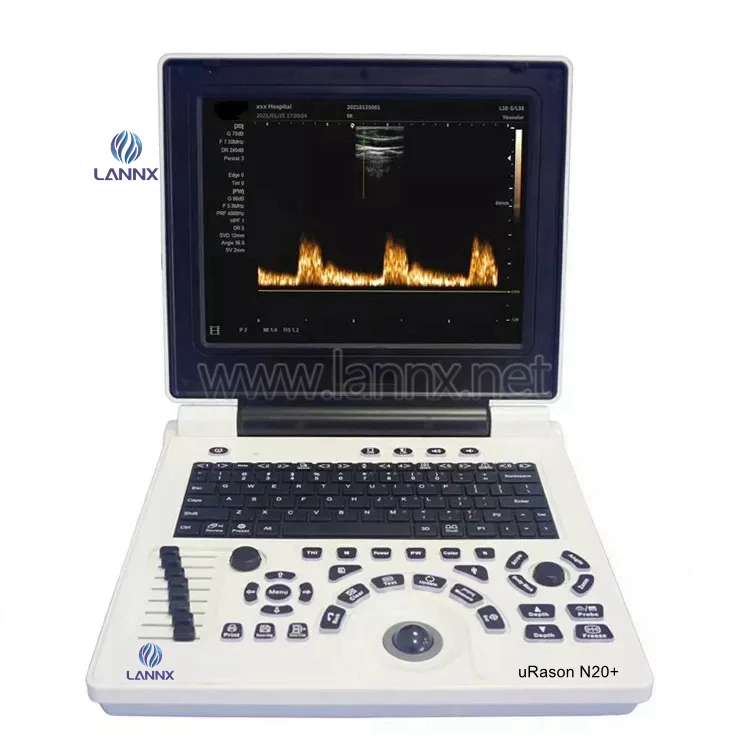 

LANNX uRason N20+ New type Portable full Digital Ultrasound Machine ultrasound diagnostic system Ultrasonic Imaging Scanner