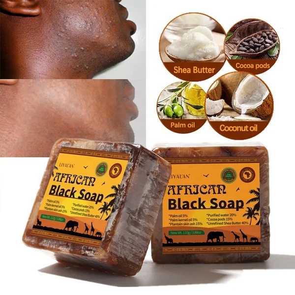 Wholesale Natural Organic Raw Whitening Acne Scar Removal Skin Care Handmade African Black Soap For Face & Body Wash
Wholesale Natural Organic Raw Whitening Acne Scar Removal Skin Care Handmade African Black Soap For Face & Body Wash