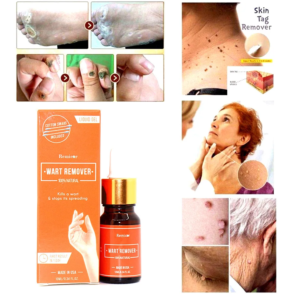 wart remover serum (2).jpg