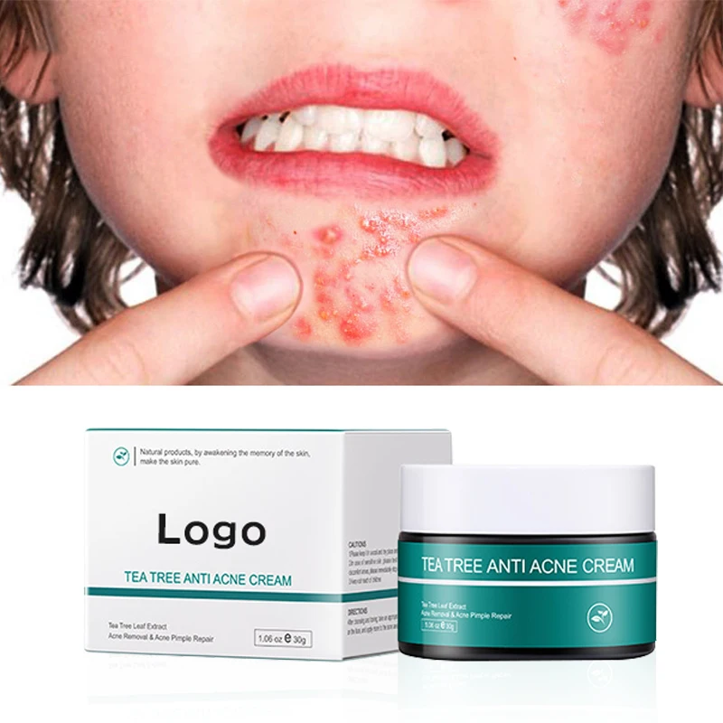 OEM ODM Acne Cream Cremas Crema Hidratante Natural Tea Tree Oil Scars Remove Cream Creme Visage Skin Moisturizing Face Cream
OEM ODM Acne Cream Cremas Crema Hidratante Natural Tea Tree Oil Scars Remove Cream Creme Visage Skin Moisturizing Face Cream