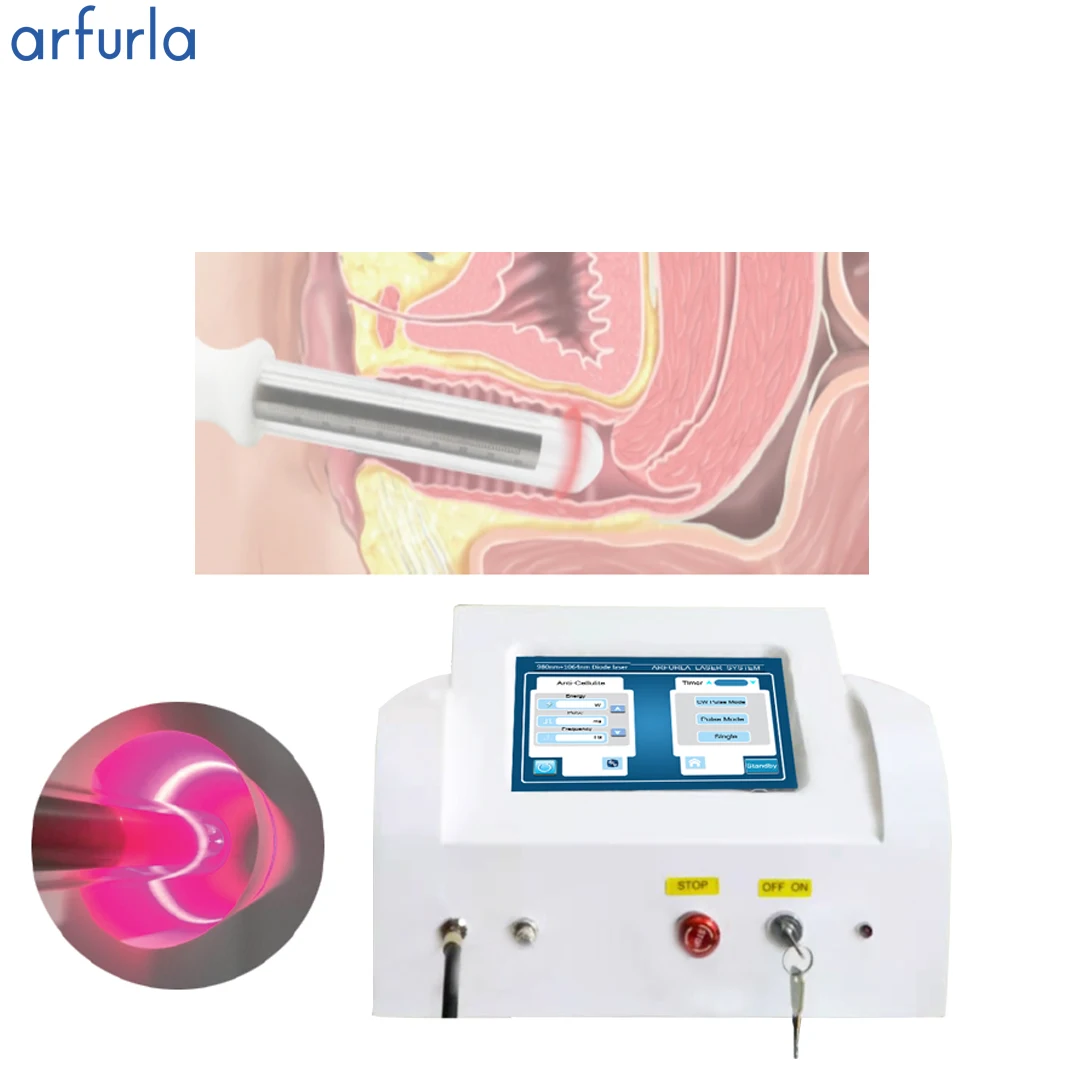 360 degree Arfurla vaginal tightening device vaginal tightening machine for elastic muscle
360 degree Arfurla vaginal tightening device vaginal tightening machine for elastic muscle