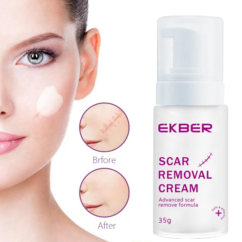 50% Off New Arrival 2022 Ekber Cream For Repair Restore Damaged Skin Shallow Facial & Body Scars And Acne Marks Removal Cream
50% Off New Arrival 2022 Ekber Cream For Repair Restore Damaged Skin Shallow Facial & Body Scars And Acne Marks Removal Cream