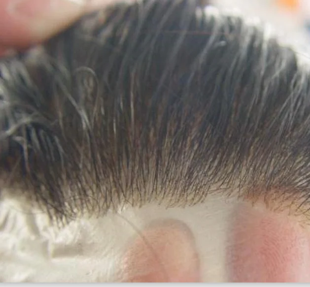 customer's own hair 022402 100% density middle part 0.5inch super thin skin around just for our customer Y
customer's own hair 022402 100% density middle part 0.5inch super thin skin around just for our customer Y