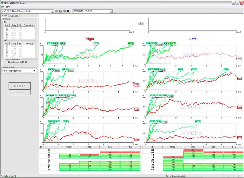 abr viewer portable