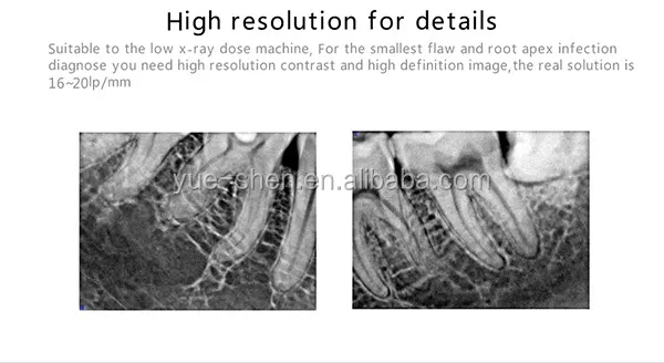 dental x ray sensor price.jpg