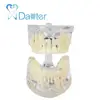 Standard teeth teaching dental model portable dental unit for dentist