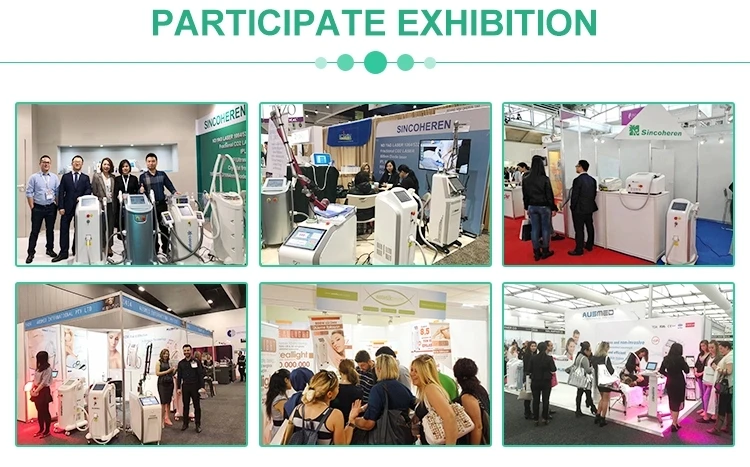 2020 painless 808nm ice diode lase hair removal machine/alexandrite laser hair removal machine price