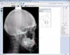WinCeph ver. 11 Orthodontic Cephalometric Analysis Software (Standard Type)