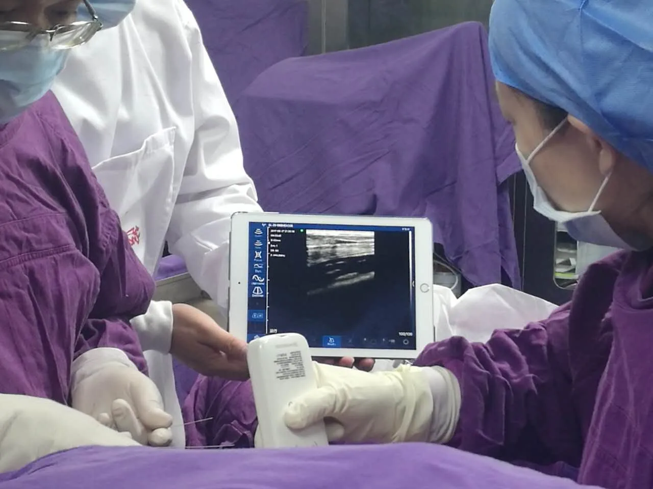 Wireless ultrasound scanner