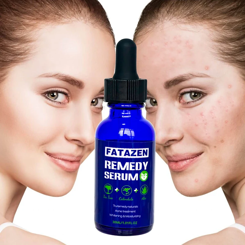 

Private Label Natural Organic Remedy Serum Acne Treatment Skin Care Facial Serum For Oily Skincare Green Tea Vitamin C Serum