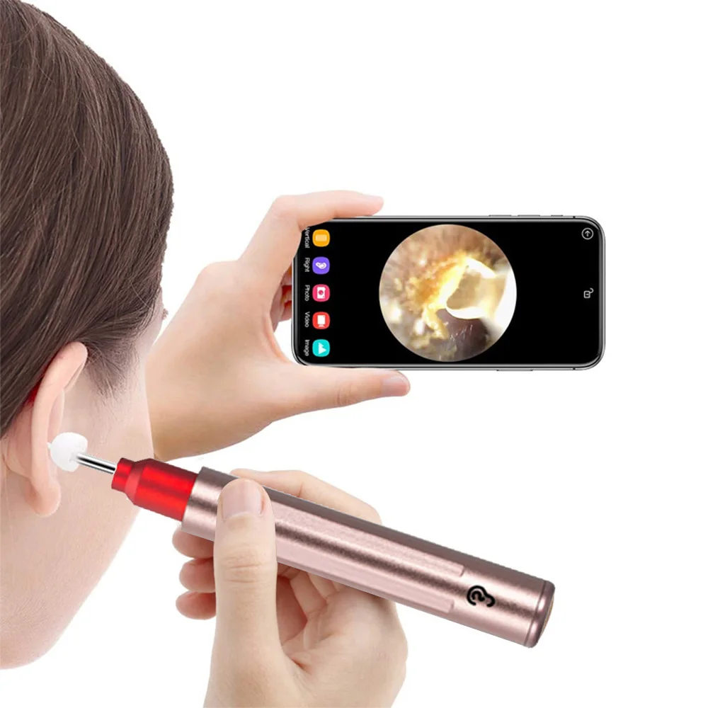 

Good price Wireless Connected Compatible with *Phone *Pad Android Smart Phones Tablets ear wax remover vacuum cleaner