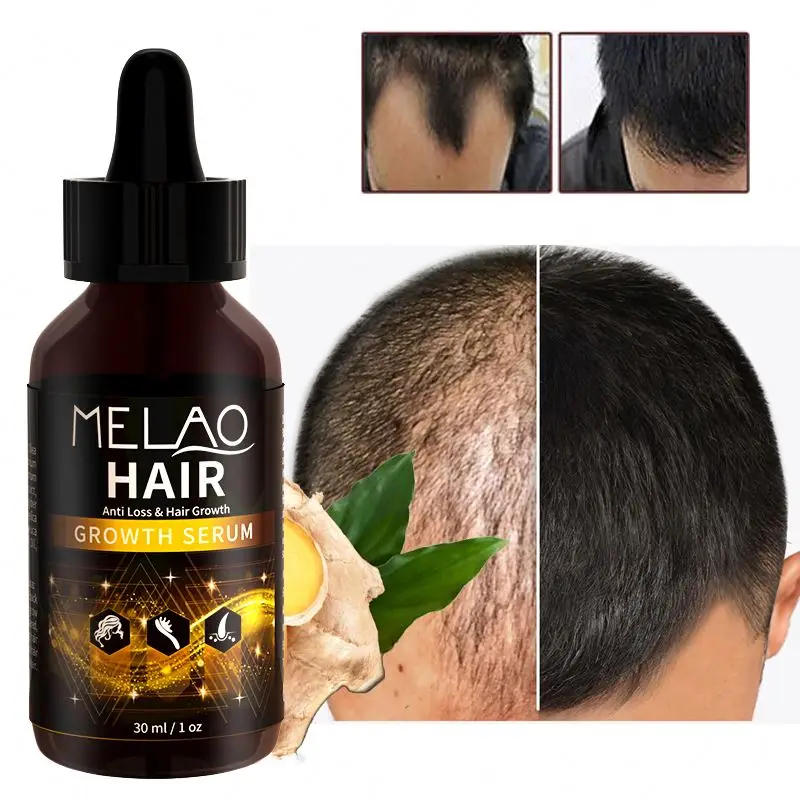 

Private Label Natural Hair Growth Serum Vegan Organic Nourishing Scalp Hair Care Oil 30ml, Customized