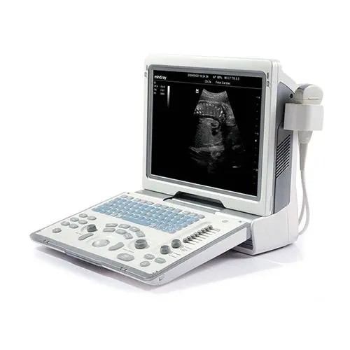Dp-50 ultrasound machine cost in amazon for sale