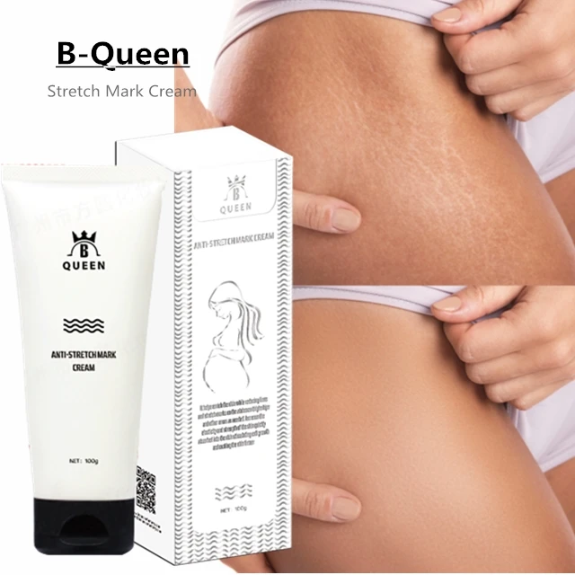 

Black Woman Cellulite and Stretch Mark Cream for Scar Removal, White