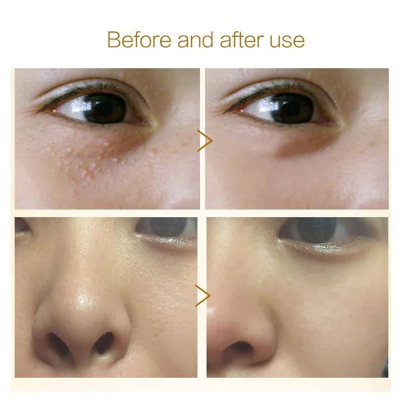 Crystal Collagen Eye Treatment Mask Anti-Puffiness Dark Circle Moisturizing Eyes Masks Beauty Skin Care