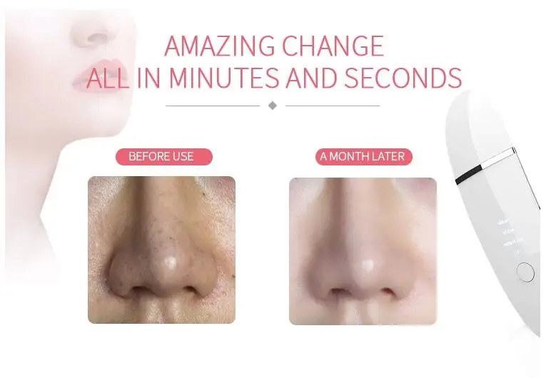 amazon best beauty facial face scrubber skin black head removal home use facial skin scrubber 2020 anlan 3 in 1 skin scrubber 