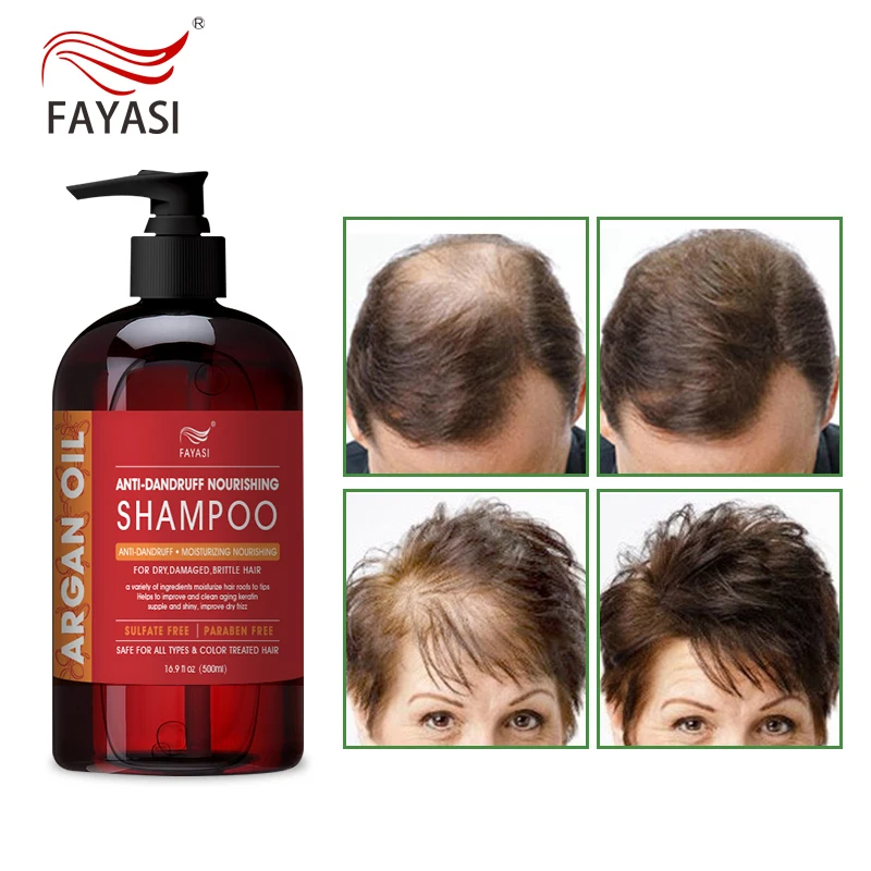 

Private Label Shampoo Shanmpoo And Conditioner With Price