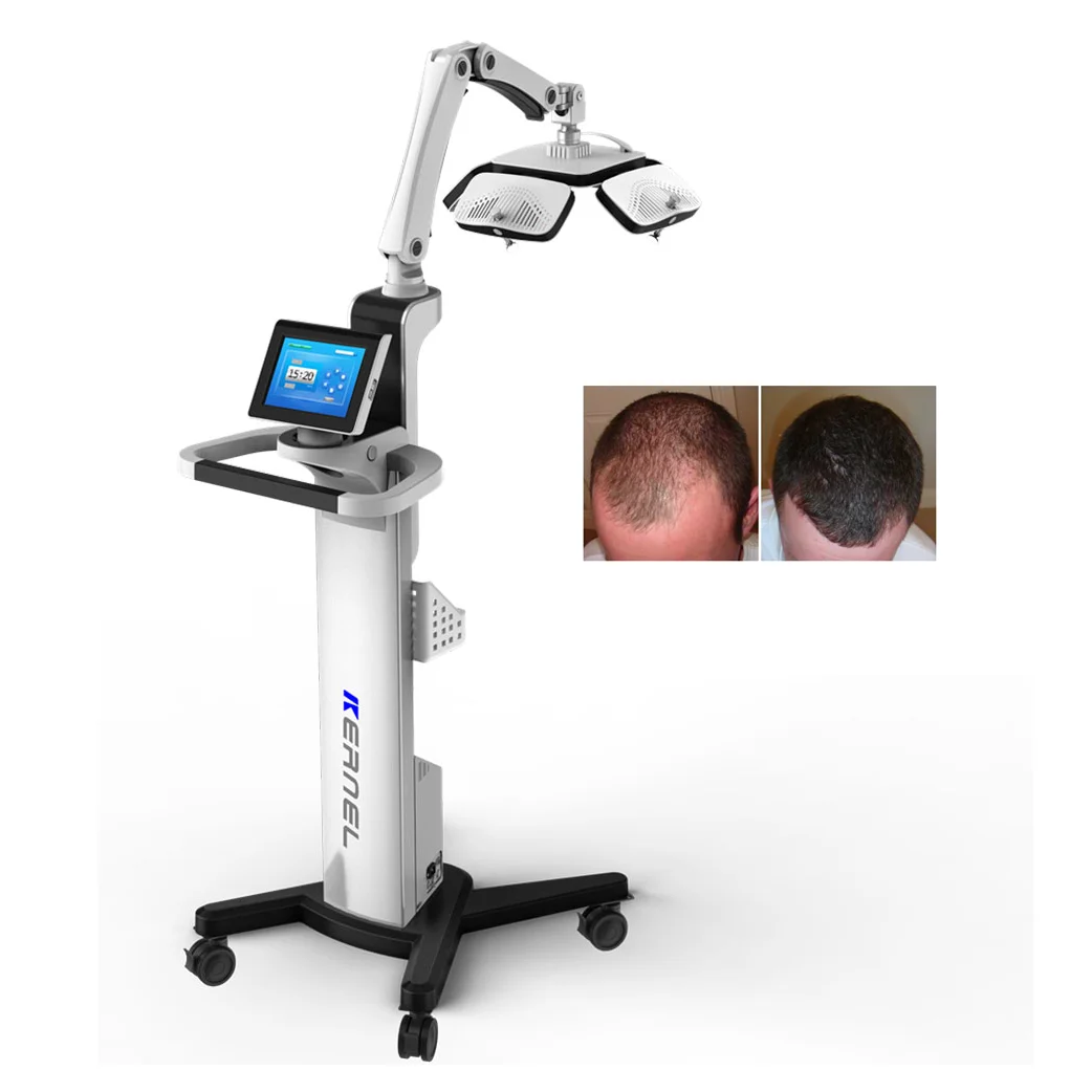 

Hot Sale Diode Laser 650nm scalp treatment laser helmet hair growth machine