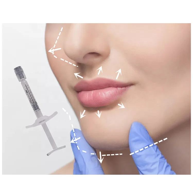 

Cross linked Hyaluronic acid dermal filler anti aging facial BD needle Ultra smile lip enlargement botax influvac injection