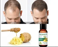 

Wholesale anti hair loss care repairing serum essence ginger oil women hair growth oil for men serum hair regrowth serum