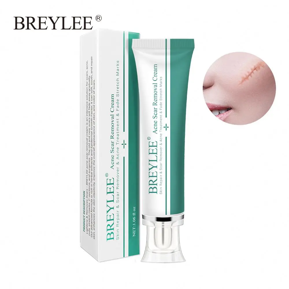 

BREYLEE Acne Scar Removal Cream 30g Face Cream Skin Repair Skin Care Scar Acne Treatment Remove Stretch Marks Whitening Cream