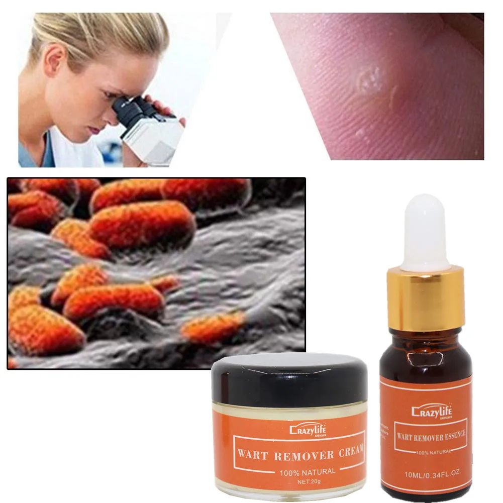 Body Warts Treatment Cream Skin Tag Remover Foot Corn Removal Essence