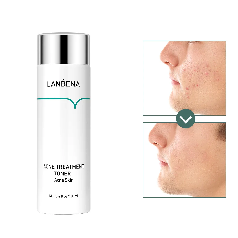 

LANBENA oilgopeptide organic anti acne hydrating face toner sensitive skin, As photo